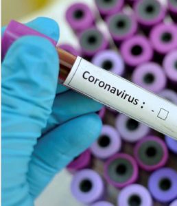coronavirus business interruption